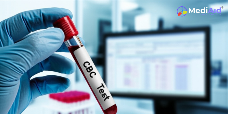 CBC Test – RBC, WBC, Hemoglobin | সিবিসি টেস্ট কী ও কেন